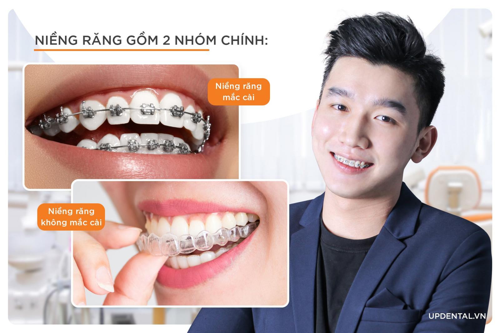 NIỀNG RĂNG LÀ GÌ? NHỮNG ĐIỀU CẦN BIẾT TRƯỚC KHI NIỀNG RĂNG