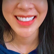 Răng sứ thẩm mỹ