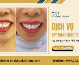 Dịch vụ tẩy trắng răng thẩm mỹ tại nha khoa uy tín quận Tân Phú hiện nay