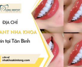 Implant nha khoa là gì? Đâu là nha khoa trồng Implant uy tín tại Tân Bình?