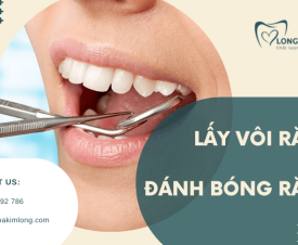 Lấy vôi răng và đánh bóng tại Tân Phú - Trả lại nụ cười trắng sáng tự nhiên