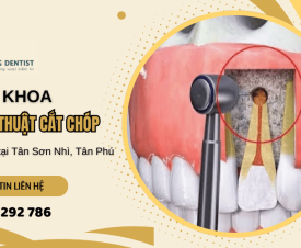 Nha khoa phẫu thuật cắt chóp an toàn và chính xác tại Tân Sơn Nhì, Tân Phú 