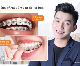 NIỀNG RĂNG LÀ GÌ? NHỮNG ĐIỀU CẦN BIẾT TRƯỚC KHI NIỀNG RĂNG