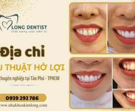 Phẫu thuật cười hở lợi ở đâu tốt nhất hiện nay tại Tân Phú, TPHCM?