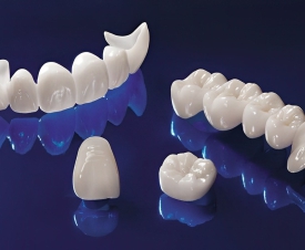 RĂNG SỨ THẨM MỸ LÀ GÌ? ƯU NHƯỢC ĐIỂM CỦA RĂNG SỨ THẨM MỸ