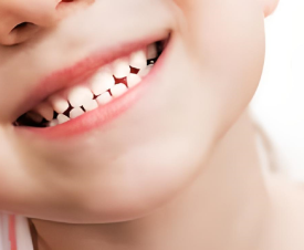 SỰ QUAN TRỌNG CỦA VIỆC CHĂM SÓC RĂNG SỮA