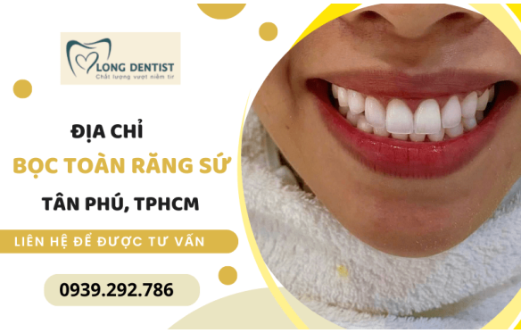 Địa chỉ bọc toàn răng sứ giá rẻ, chất lượng cao tại Tân Phú, TPHCM 