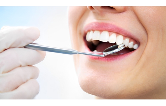 SAU KHI LÀM RĂNG SỨ NÊN KIÊNG ĂN GÌ?