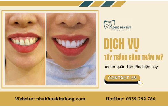 Dịch vụ tẩy trắng răng thẩm mỹ tại nha khoa uy tín quận Tân Phú hiện nay