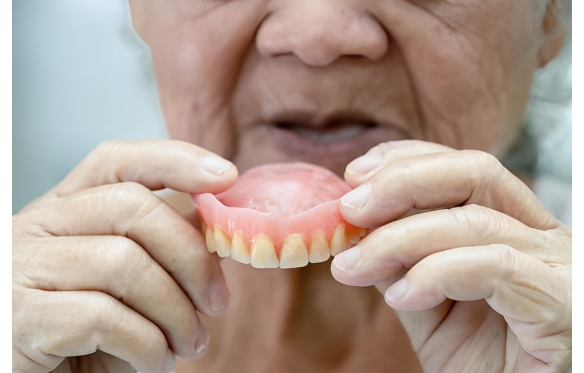 HÀM RĂNG GIẢ VÀ NHỮNG ĐIỀU BẠN CẦN BIẾT