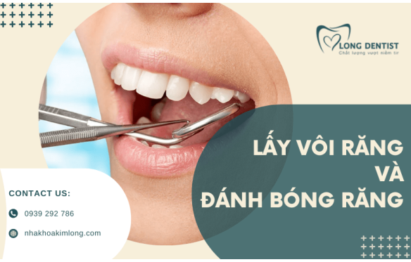 Lấy vôi răng và đánh bóng tại Tân Phú - Trả lại nụ cười trắng sáng tự nhiên
