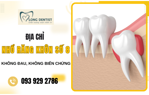 Nha Khoa Kim Long - Nơi nhổ răng khôn số 8 không đau, không biến chứng
