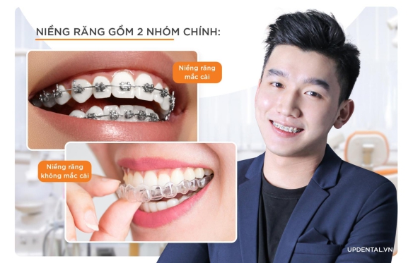 NIỀNG RĂNG LÀ GÌ? NHỮNG ĐIỀU CẦN BIẾT TRƯỚC KHI NIỀNG RĂNG