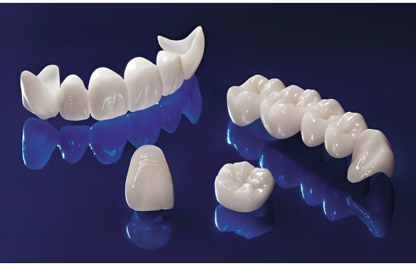 RĂNG SỨ THẨM MỸ LÀ GÌ? ƯU NHƯỢC ĐIỂM CỦA RĂNG SỨ THẨM MỸ