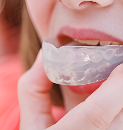 CHỈNH NHA DỰ PHÒNG ( THÁO LẮP )