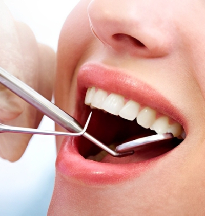 Lấy Vôi Răng Và Đánh Bóng Răng