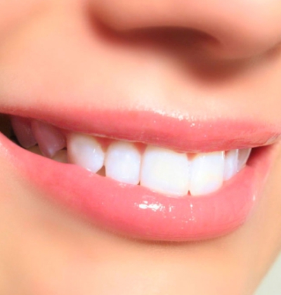 Mặt Dán Sứ Ceramill Zolid