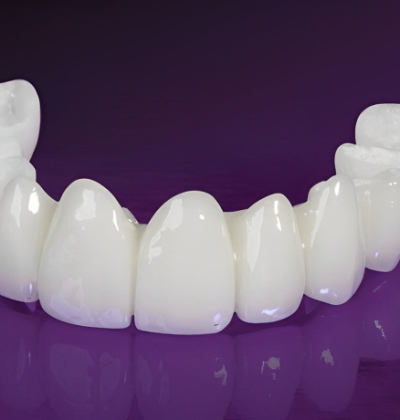 Răng Toàn Sứ LAVA PLUS