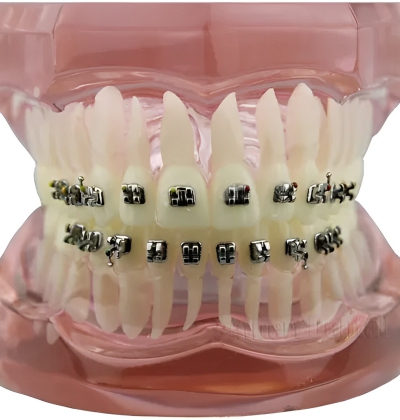 CHỐT BỊ - MẮC CÀI BỊ (ĐƠN-ĐÔI)