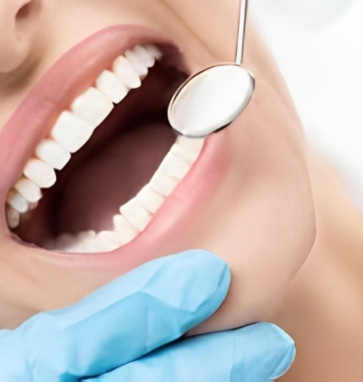 Trám Răng Thẩm Mỹ
