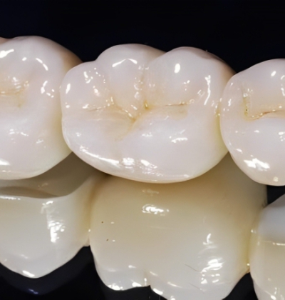 Răng Toàn Sứ CERAMILL ZOLID - ĐỨC