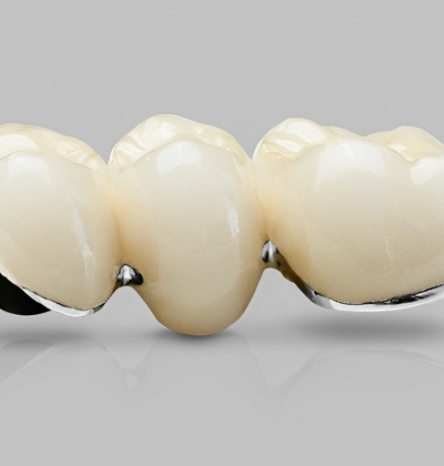 Răng Sứ CERAMCO