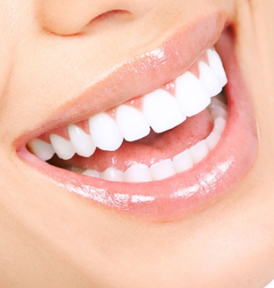 Mặt Dán Sứ Lava Plus